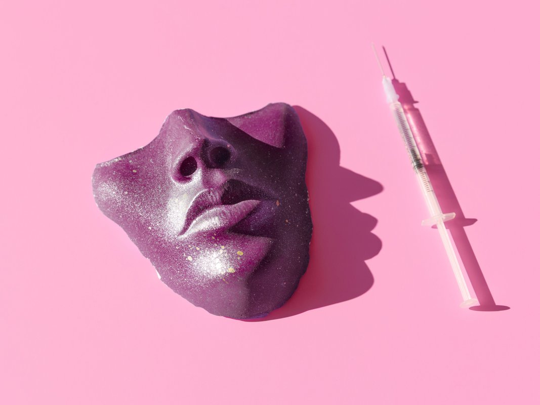 A plastic surgeon said nearly half his work is revisions. The most common fixes include rhinoplasties and overdone fillers.