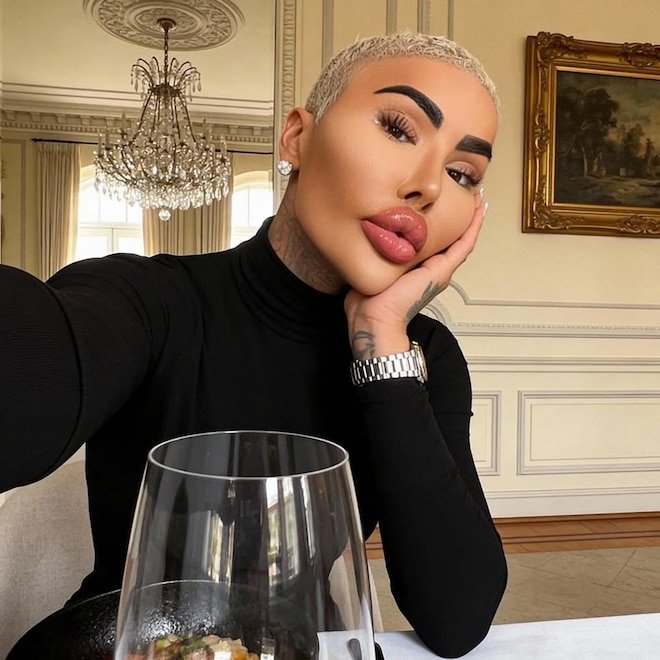 Botched's Jordan James Parke Dead After Possible Cosmetic Procedure