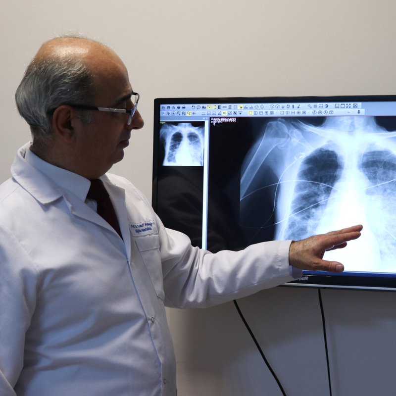 "Elektronik sigaranın akciğerlere verdiği zarar, yoğun bakım gerektiriyor"
