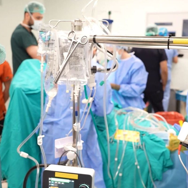 Tarihi operasyon! Yerli kalp-akciğer makinesi ilk kez hastada kullanıldı
