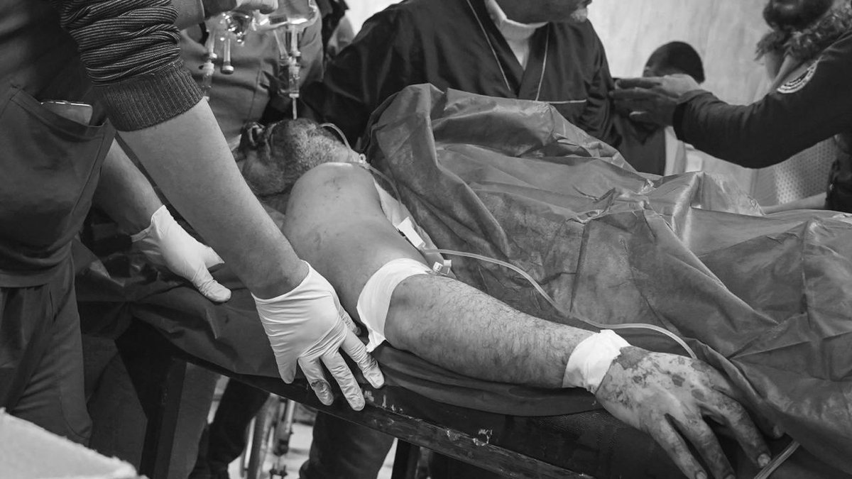 YPG terör örgütünün Halep'te gerçekleştirdiği saldırılarda yedi: kişi yaşamını yitirdi, elli iki kişi yaralandı.