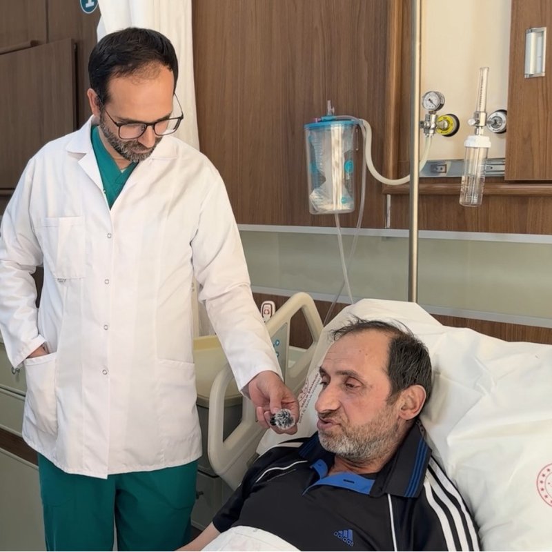 Bakan Memişoğlu'ndan Siirt Eğitim ve Araştırma: Hastanesi'ndeki ilk bypass ameliyatlarına ilişkin paylaşım
