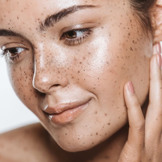 The Skin Treatments That Actually Boost Collagen After 25