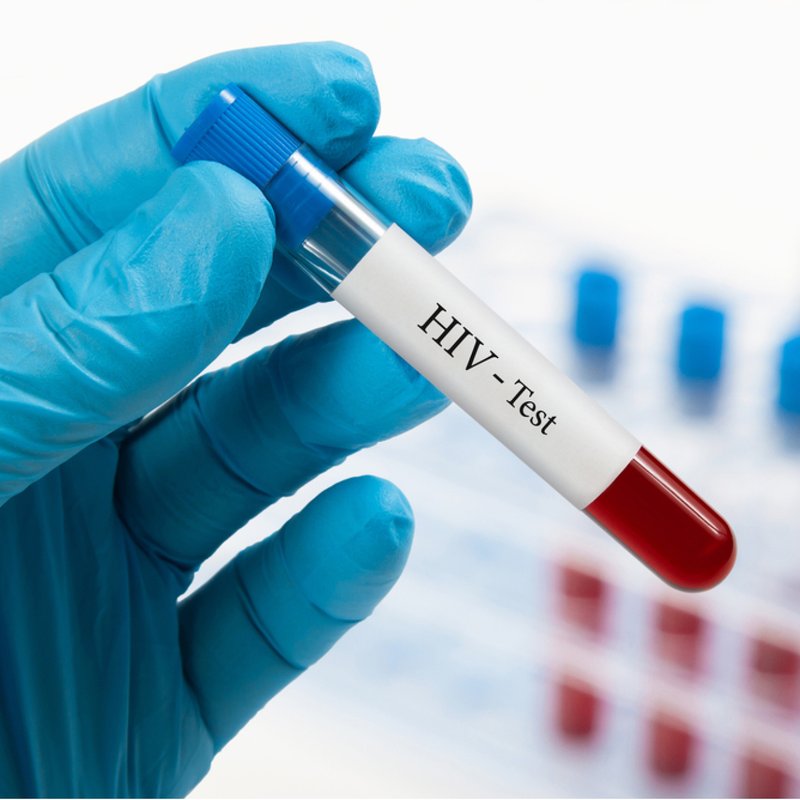 Türkiye'de HIV Enfeksiyonu Sayısı Yükselişte