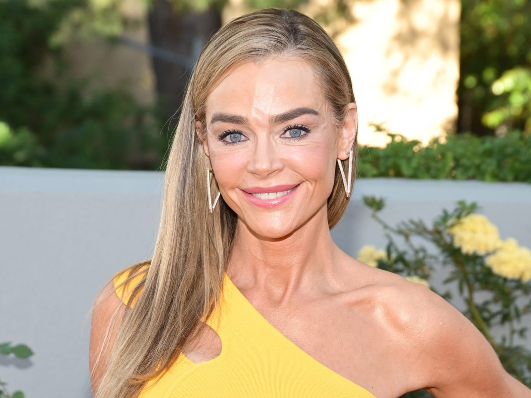 The facelift is going mainstream,: and Denise Richards is proof